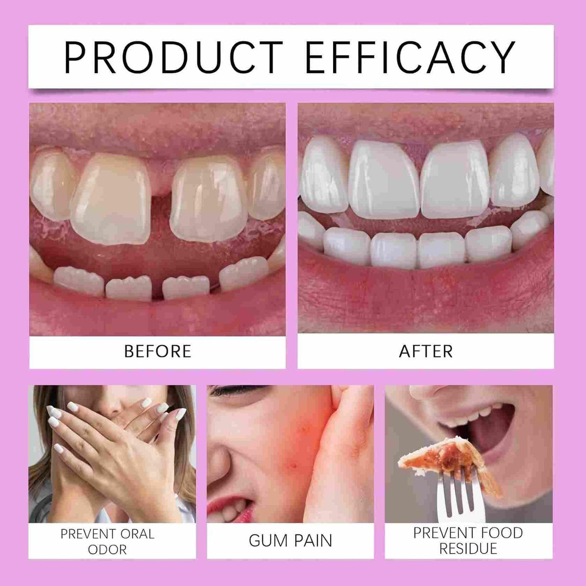 Adjustable Silicone Full-Mouth Denture Set O41994