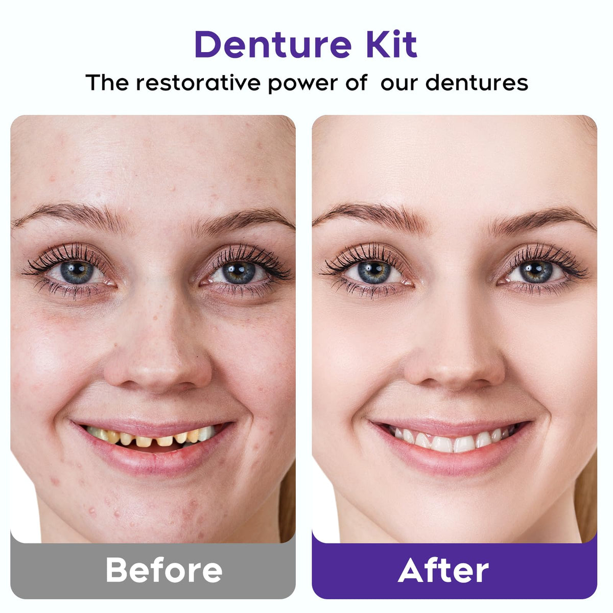 DIY Denture Kit for Upper & Lower Teeth B185