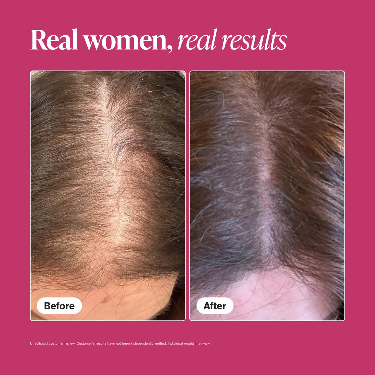 Hair Growth Supplements for Women, 60 Tablets N346370